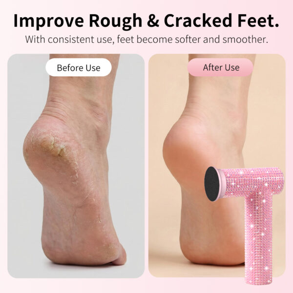 主图5 FG12D Foot Callus Remover-Pink Diamond